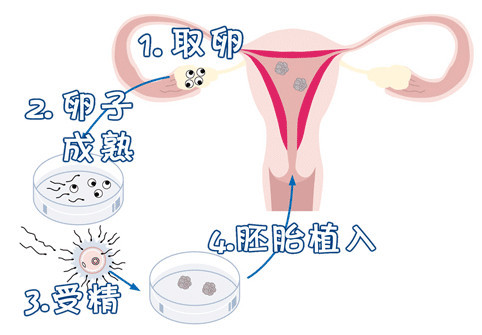 关于极光